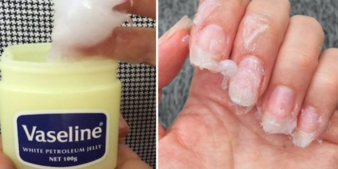 18 Verwendungen von Vaseline